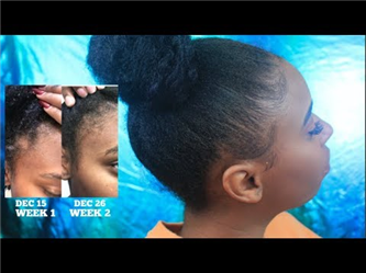 Virgin Hair Fertilizer for Hair Growth Cream