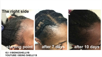 Virgin Hair Fertilizer Cape Town