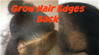 Virgin Hair Fertilizer Itchy Scalp