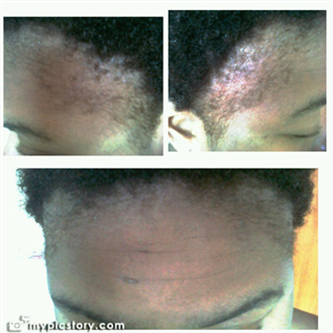 Jrb Virgin Hair Fertilizer