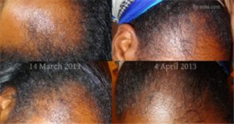 What Is in Virgin Hair Fertilizer